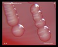 escherichia coli